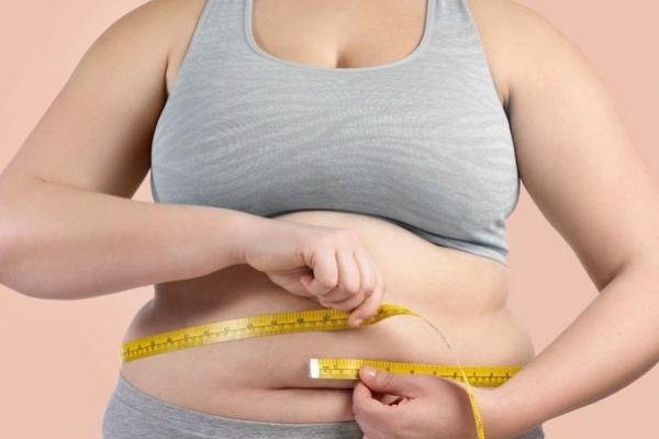 Ilustrasi penderita obesitas (FOTO: SHUTTERSTOCK) 