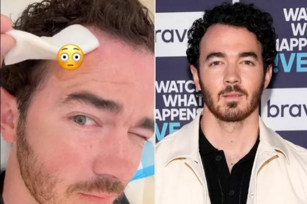 Istirahat Tur Dunia, Kevin Jonas Lakukan Operasi Kanker Kulit Kecil