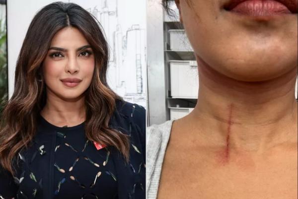 Syuting Film Laga The Bluff, Priyanka Chopra Pamer Luka di Leher