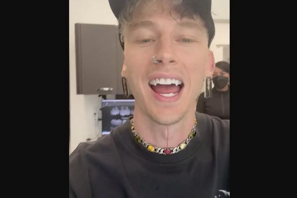 Machine Gun Kelly Tampil Perdana dengan Taring Baru Mencolok