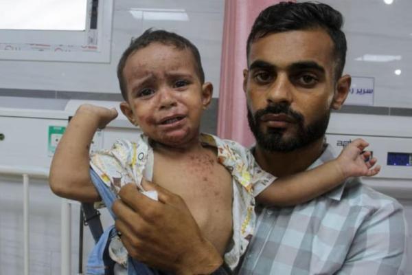 Perang Berlanjut tanpa Akhir, Penyakit Kulit Menyerang Anak-anak Gaza