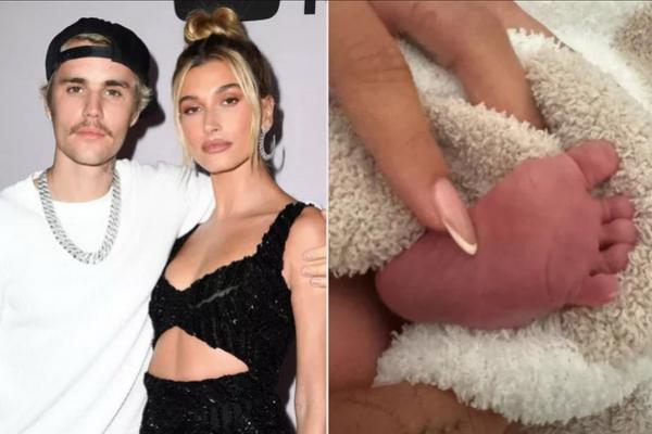 Justin Bieber dan Istri Hailey Umumkan Kelahiran Bayi Pertama, `Welcome Jack Blues Bieber`