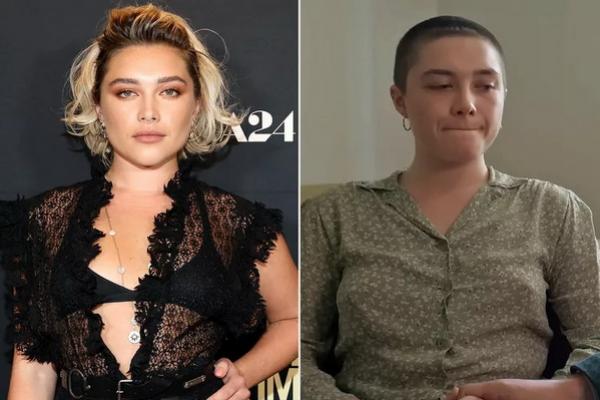 Cukur Kepalanya demi Peran We Live in Time, Florence Pugh Mengaku Trauma