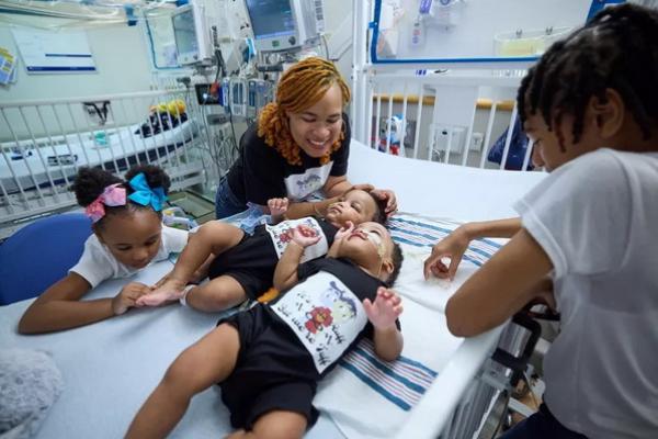 Si kembar Amari dan Javar Ruffin berbagi bagian terendah dari tulang dada, diafragma, dinding perut, dan hati. (FOTO: CHILDREN`S HOSPITAL PHILADELPHIA) 