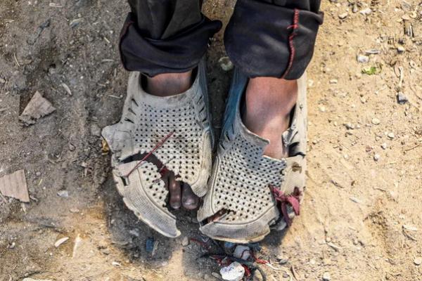 Pakaian dan sepatu anak-anak sudah rusak, sehingga mereka tidak bisa bergerak atau bermain dan tidak terlindungi dengan baik dari musim dingin yang akan datang. (FOTO: AL JAZEERA) 