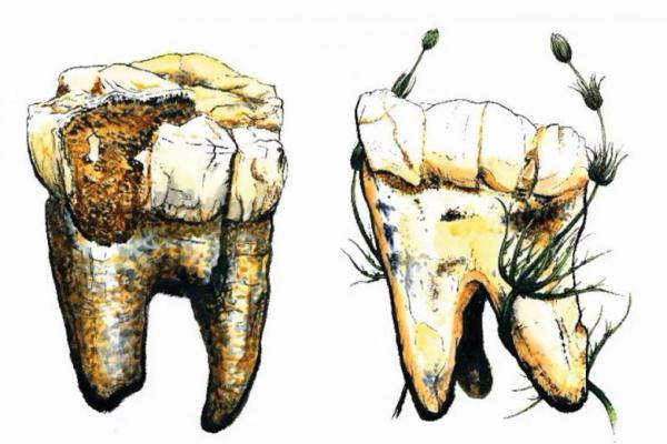 Ilustrasi dua dari tujuh gigi geraham Australopithecus, yang digali di Afrika Selatan, dan gambarnya dirilis pada 16 Januari 2025. Handout via REUTERS 