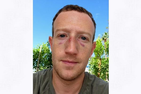 Latihan Jiu Jitsu, Mark Zuckerberg Perlihatkan Dua Matanya yang Lebam